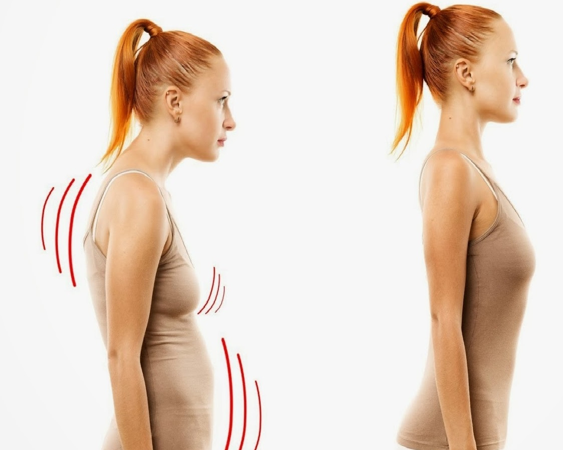 Семинар 01.03 Коррекция нарушений осанки в сагиттальной плоскости